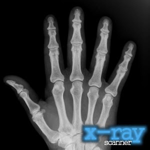 X-Ray Scanner 1.7.5